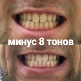 Студия косметического отбеливания зубов White&Smile фото 1