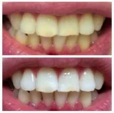 Студия косметического отбеливания зубов White&Smile фото 6